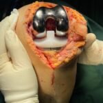 dr. Isa Shirinov (Orthopedist)