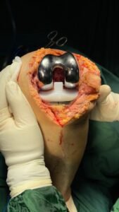 dr. Isa Shirinov (Orthopedist)