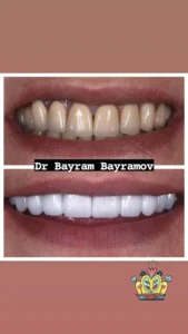 Stomatoloq Bayram
