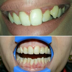 Stomatoloq Dr Nurəddin Rəşidli