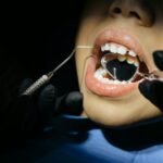 Diş implantı vs protez: fərqlər və xərclər