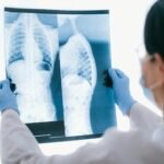 Pulmonoloq nədir? Bakıda ağciyər həkimləri