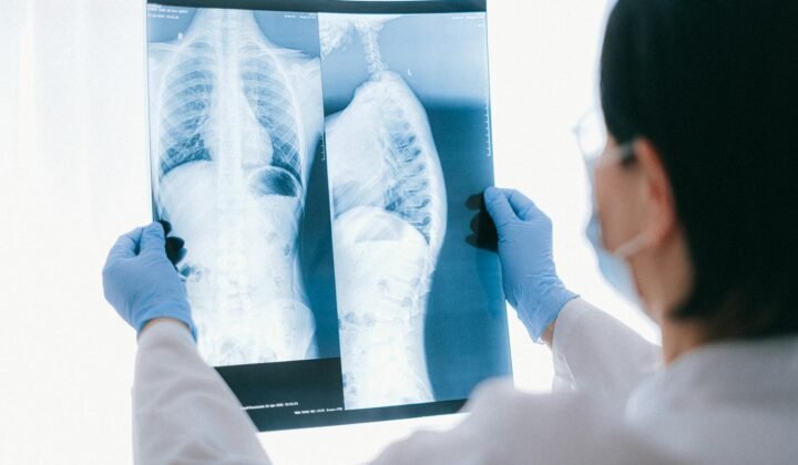 Pulmonoloq nədir? Bakıda ağciyər həkimləri