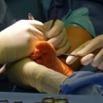 Qırıq sümük: ilk yardım, gips və sağalma müddəti